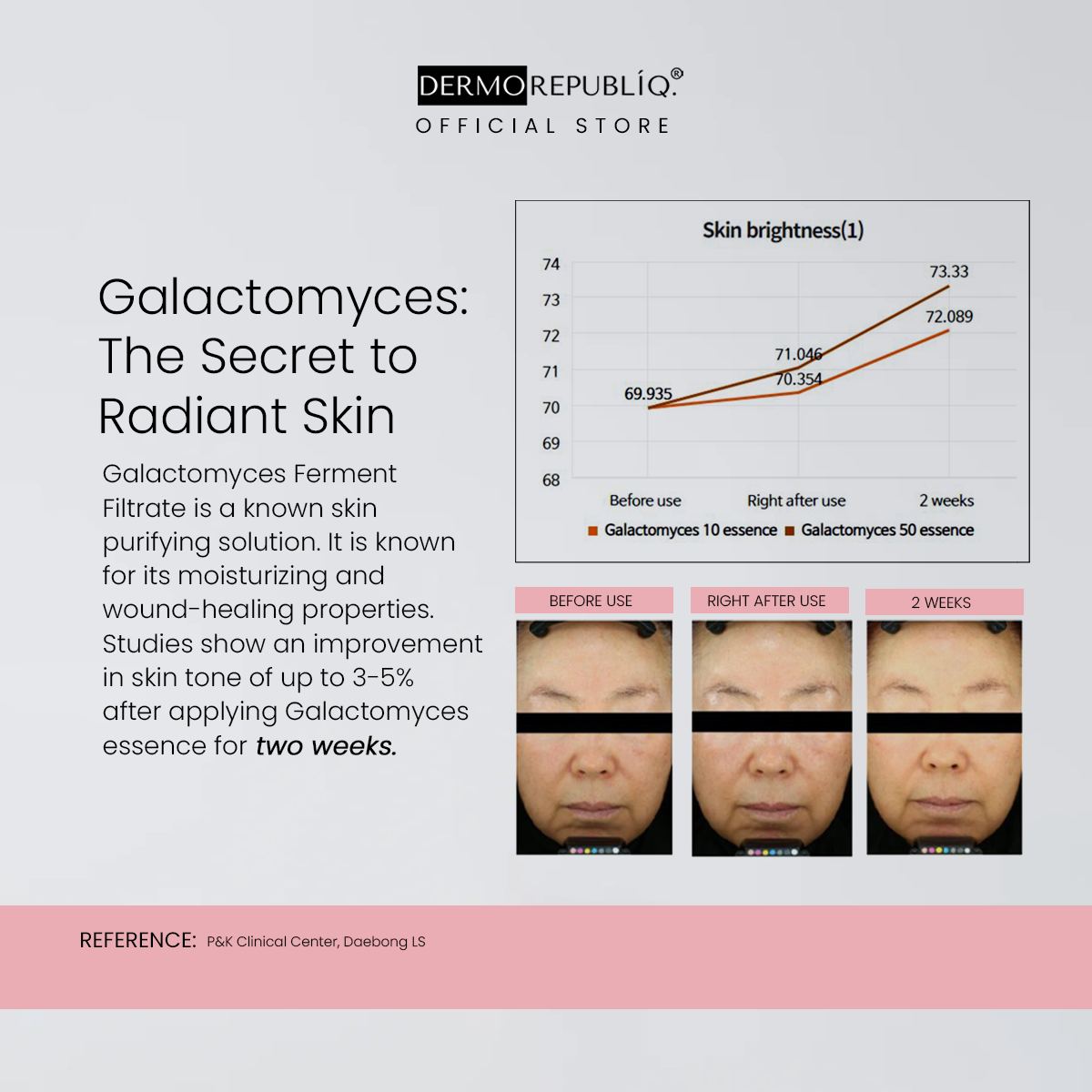 Dermorepubliq 85% Galactomyces Ampoule for Brightening - 30 mL