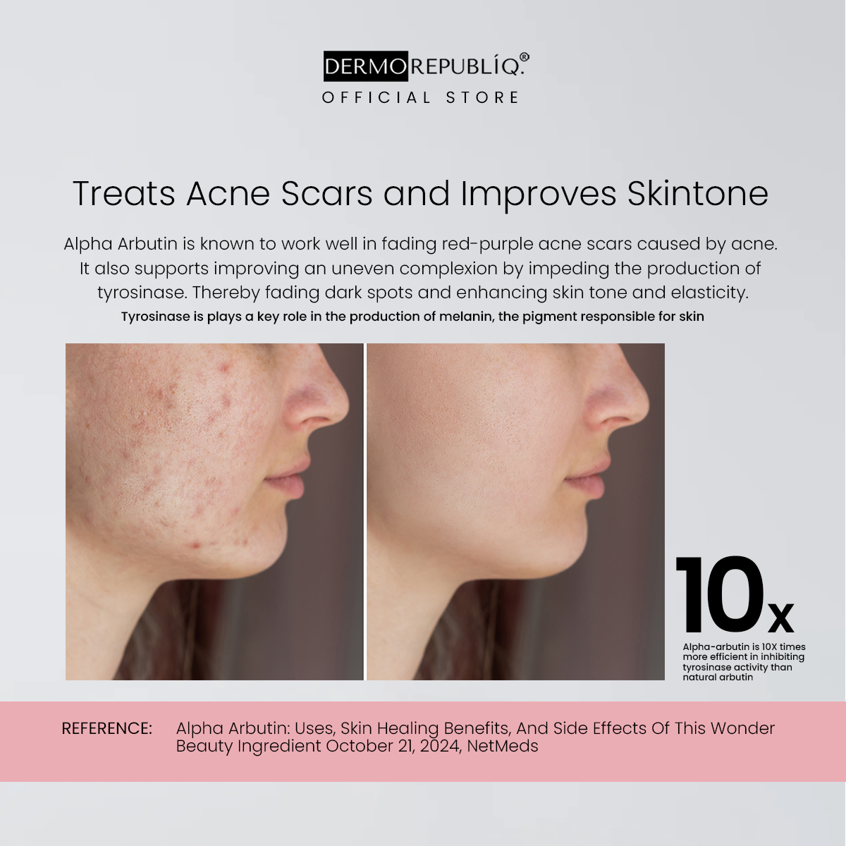 Dermorepubliq 2% Alpha Arbutin + Niacinamide + HA Dark Spot Corrector Serum - 30 mL